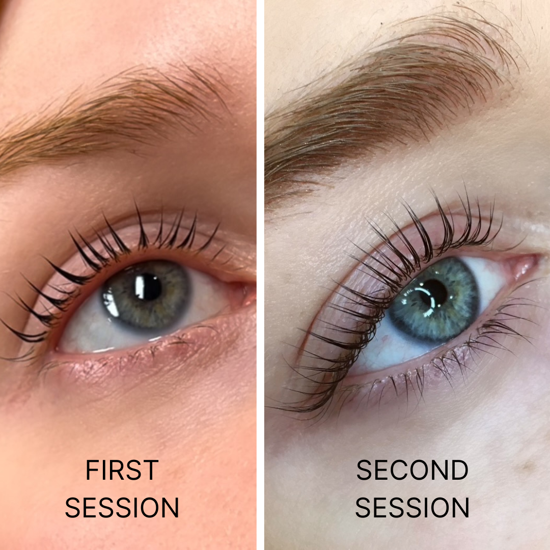 JUICY BOTOX & LIFT FULL KIT + FREE ONLINE COURSE - Juicy Botox